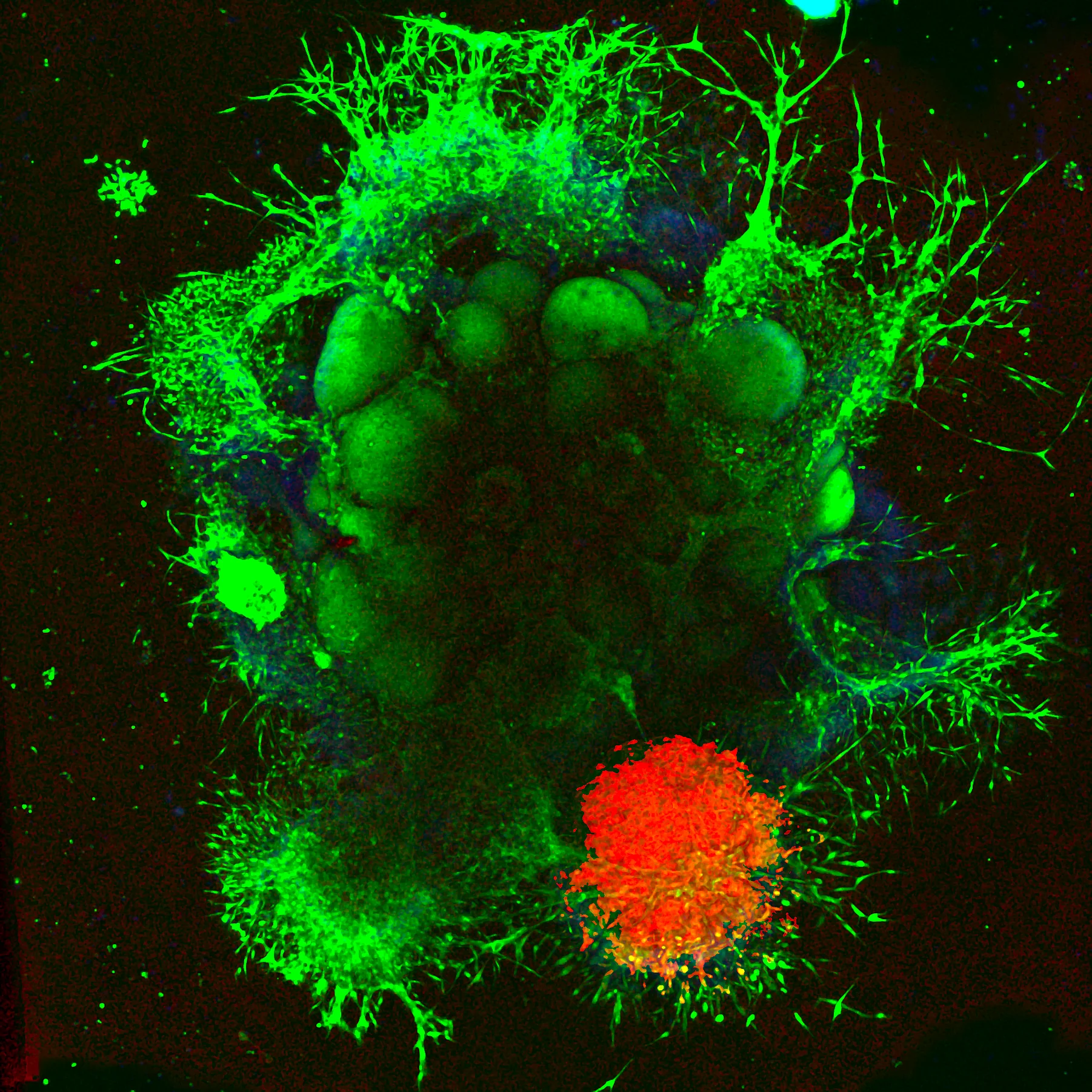 Glioblastoma organoid — bright-field microscopy